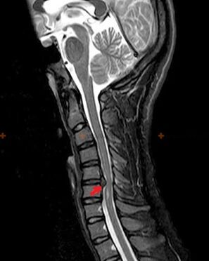 X-ray of the spine