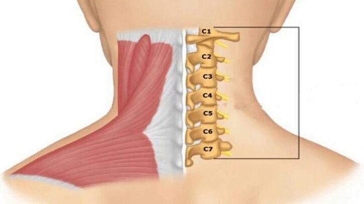 Radicular syndrome occurs depending on which vertebra compresses the nerve endings